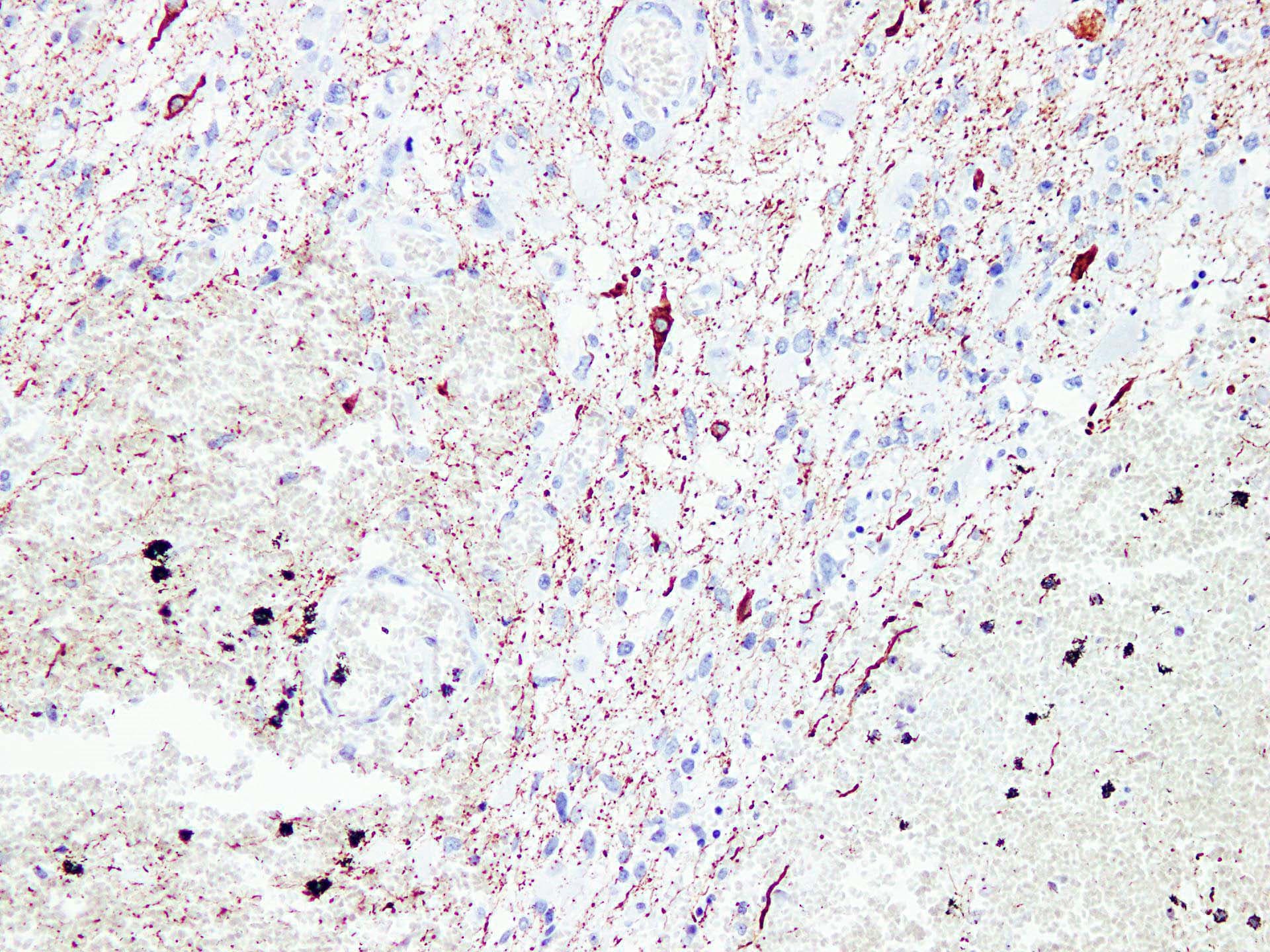 NF-L / NEFL Antibody (clone ABT-NF)