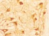 HMOX1 / HO-1 Antibody (clone HO-1-2)