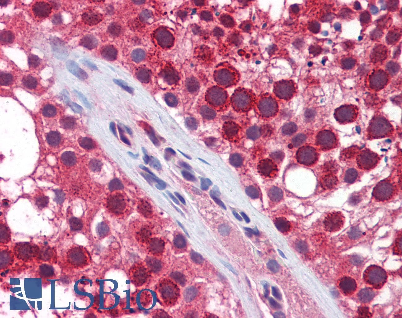 Polyclonal Rabbit anti-Human NAK / TBK1 Antibody (aa539-588, IHC, WB)