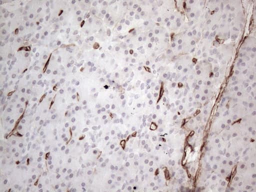 CD34 Antibody (aa312-385, clone OTI12F2)