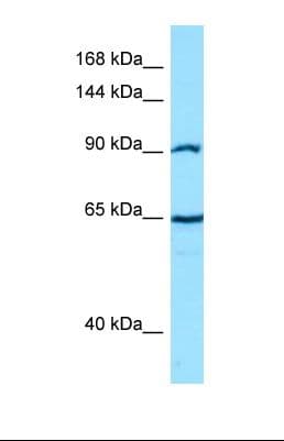 Polyclonal Rabbit anti-Human CTNNA2 / Alpha-2 Catenin Antibody (C-Terminus, WB)