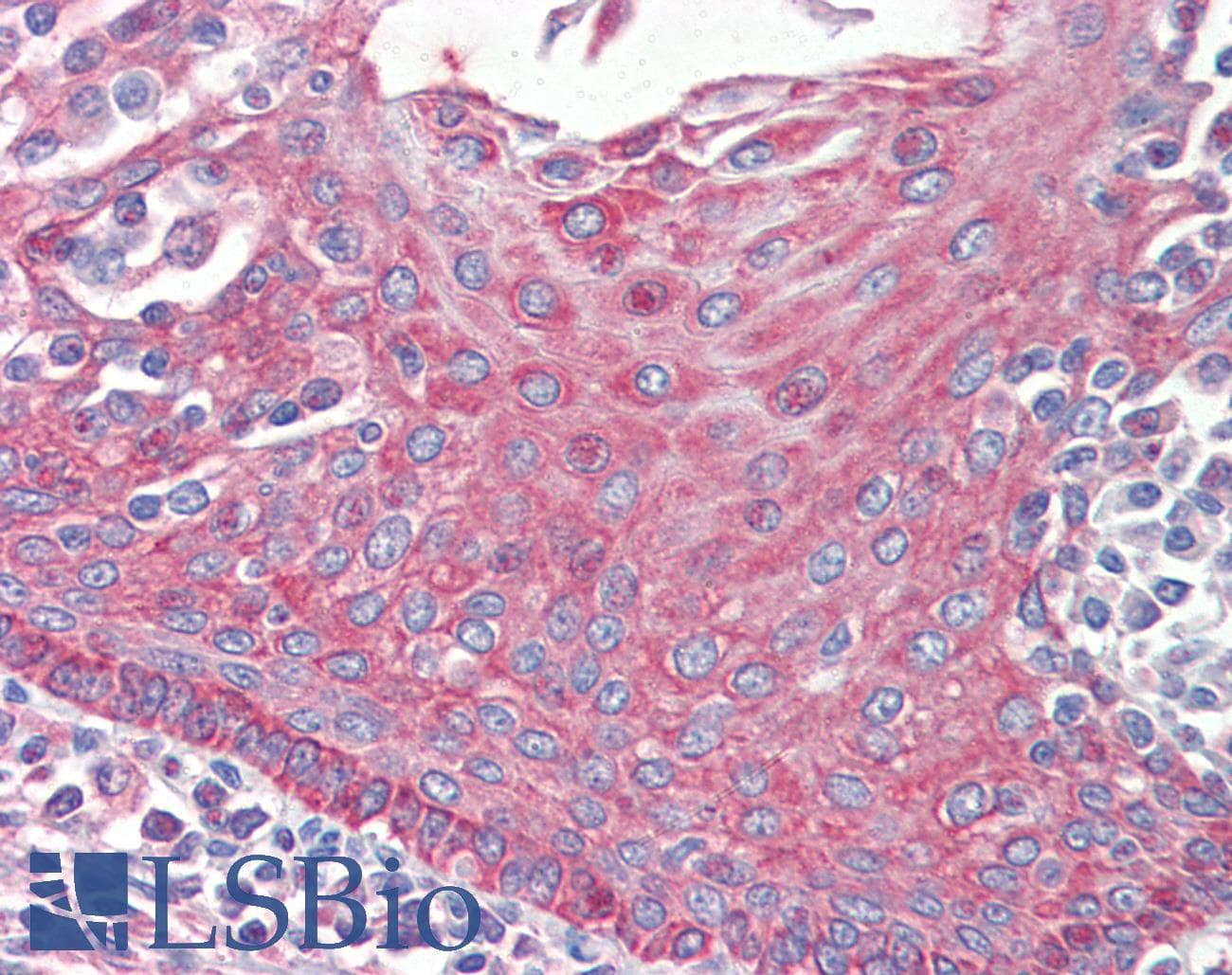 IHC-plus™ EPHB2 / EPH Receptor B2 Antibody (aa17-200, clone 2D12C6)