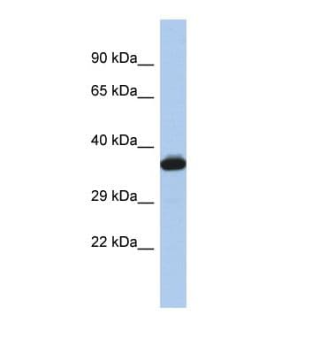 GIMAP2 Antibody (aa111-160)