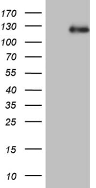 AR / Androgen Receptor Antibody (aa420-659, clone OTI2E11)