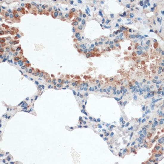 AQP4 / Aquaporin 4 Antibody