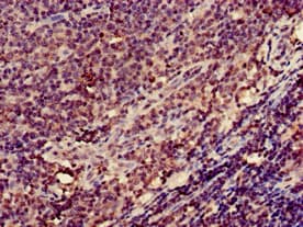 ITGB2 / CD18 Antibody
