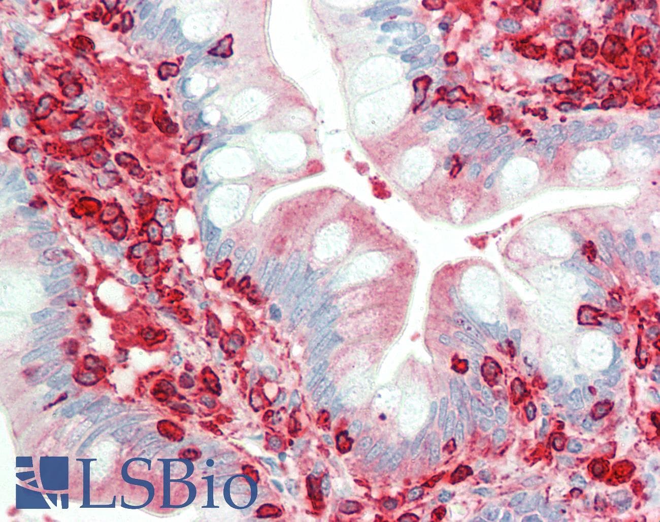 IHC-plus™ Monoclonal Mouse anti-Human ACTB / Beta Actin Antibody (clone 8H10D10, IHC, IF, WB)