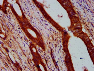 Polyclonal Rabbit anti-Human ULK2 Antibody (IHC, WB)