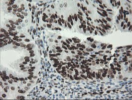 TLE1 / TLE 1 Antibody (aa180-460, clone OTI1F5)