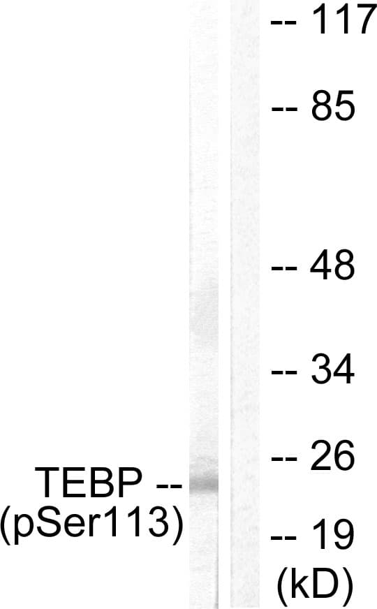 PTGES3 / p23 Antibody (phospho-Ser113)