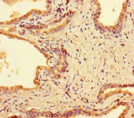 PPM1H Antibody
