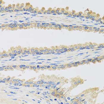 INSL3 Antibody