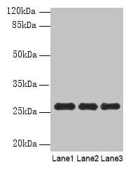 PEX11B Antibody