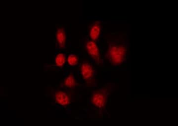 GATA1 Antibody (phospho-Ser142)