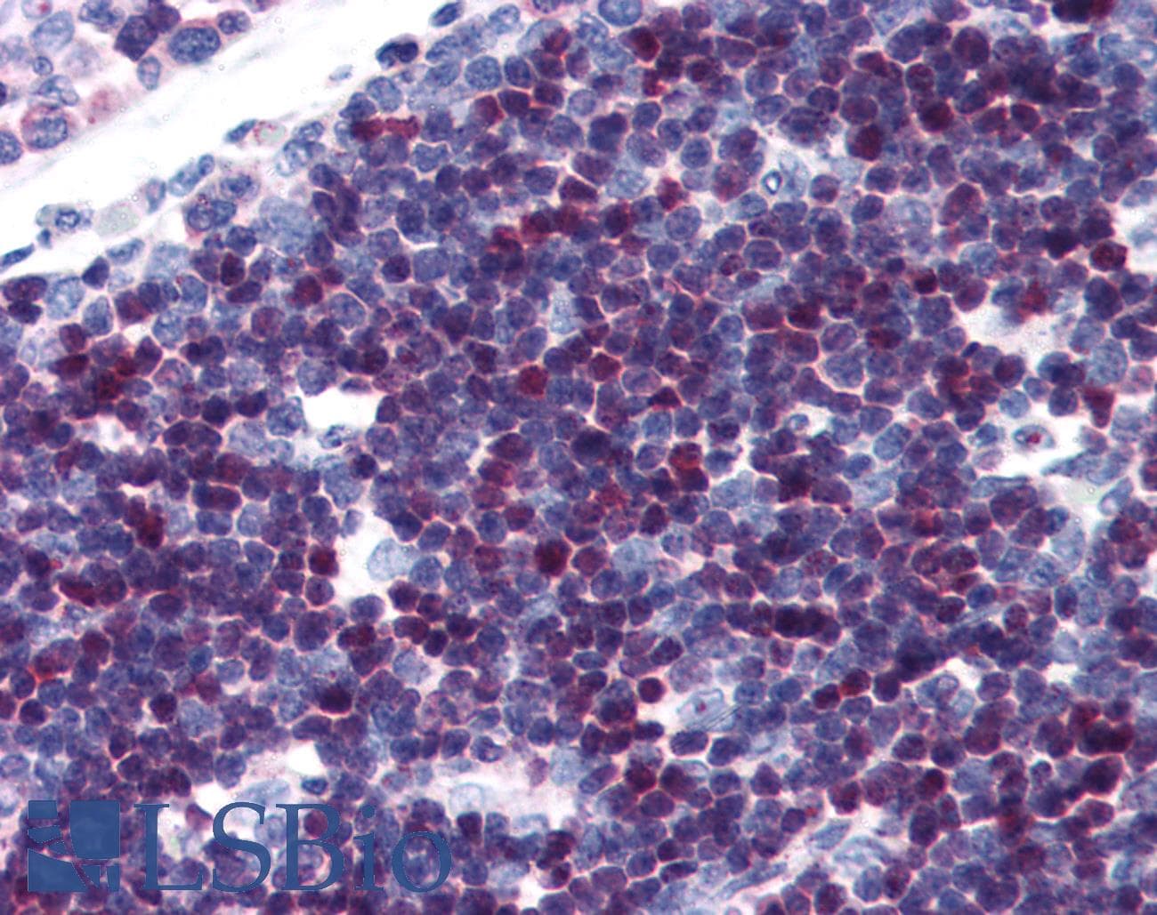 IHC-plus™ SATB1 Antibody