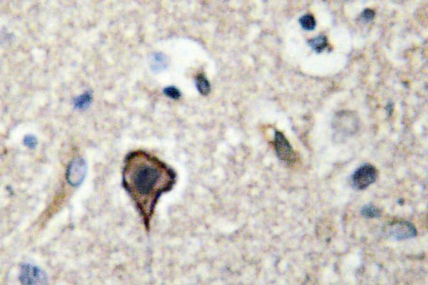 IHC-plus™ TNFSF12 / TWEAK Antibody (Pro73)