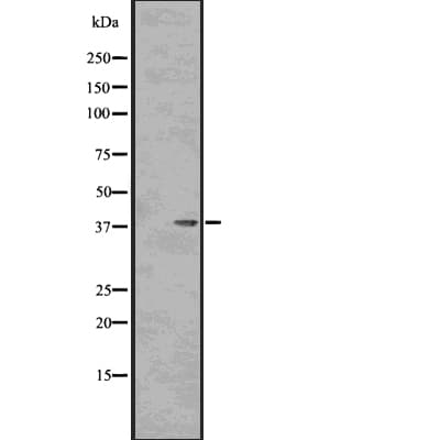 PPP1CA / PP1-Alpha Antibody (phospho-Thr320)