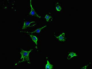 Polyclonal Rabbit anti-Human TCN2 Antibody