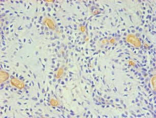 Monoclonal Mouse anti-Human CD59 Antibody (clone 2E11B6, IHC, WB)