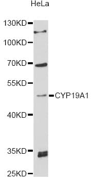 CYP19 / Aromatase Antibody