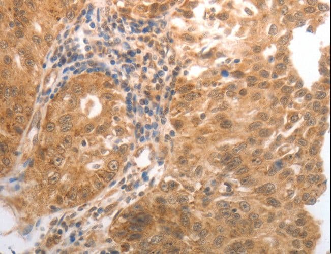 Polyclonal Rabbit anti-Human MMP27 Antibody (IHC)