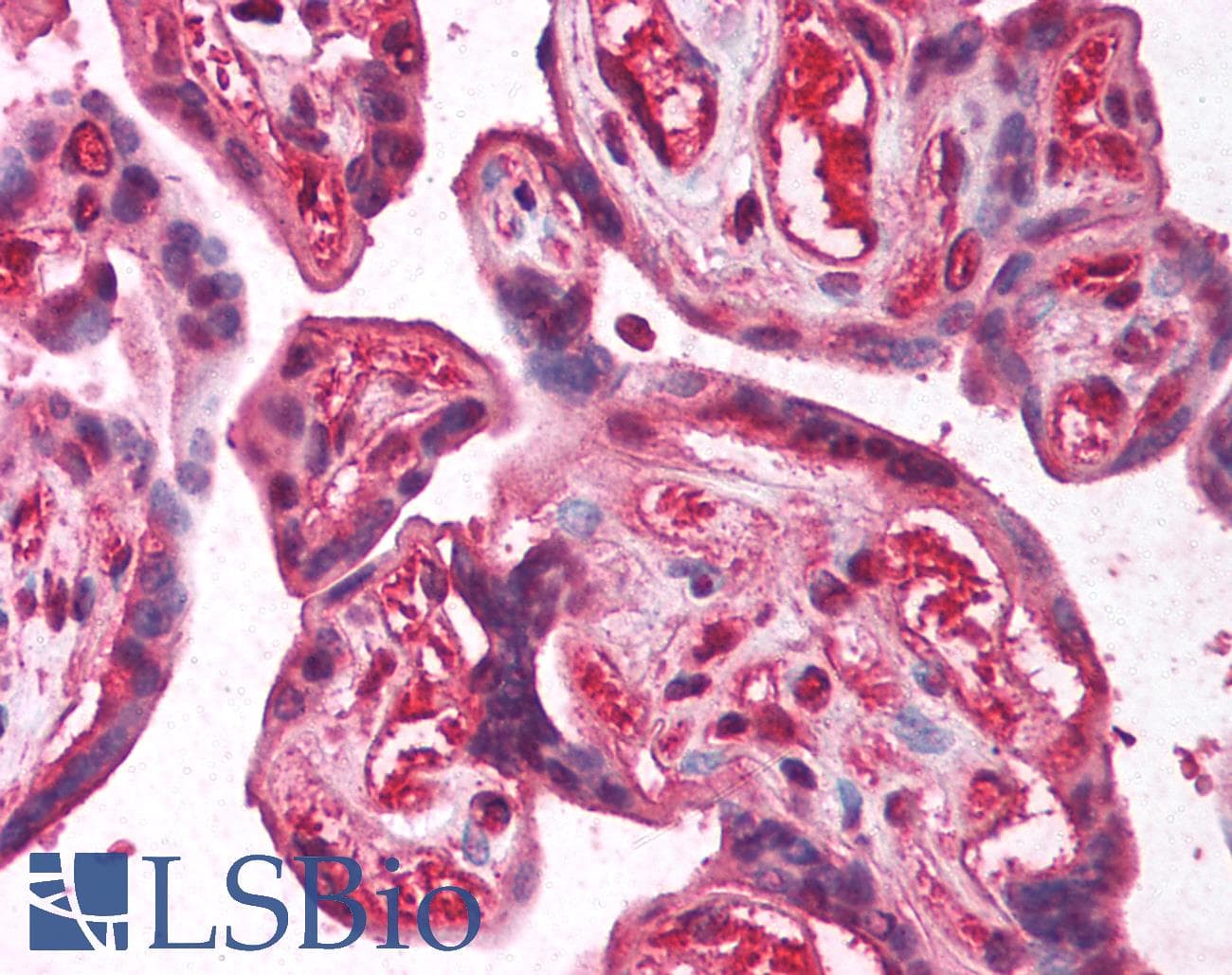 Polyclonal Rabbit anti-Human E2F2 Antibody (aa191-240, IHC, WB)