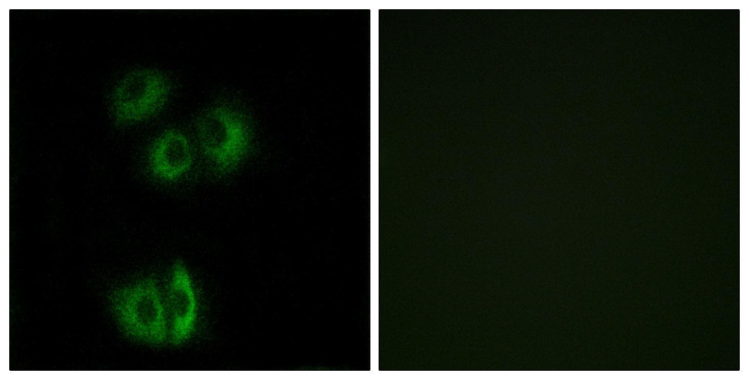 CELSR3 Antibody