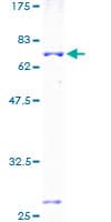 Human KCNJ15 / KIR4.2 Protein (Recombinant GST)