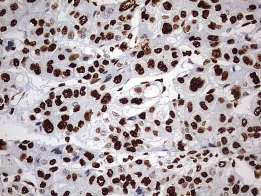 Monoclonal Mouse anti-Human HNRPM / HNRNPM Antibody (clone OTI1F6, aa1-261, IHC, WB)