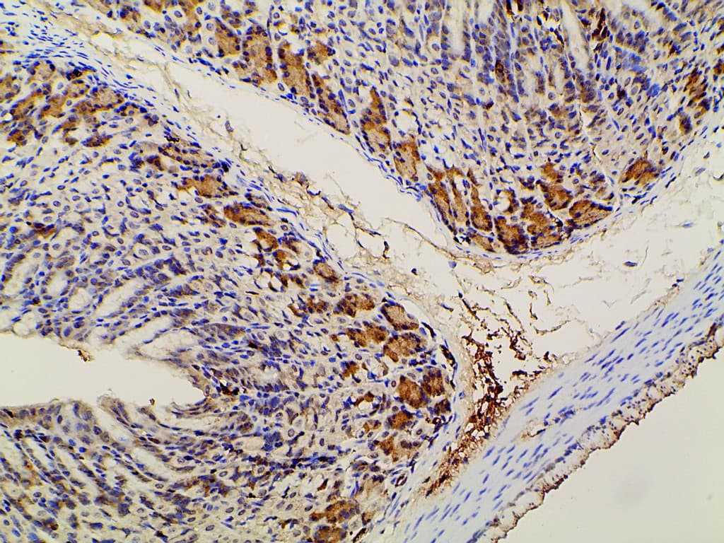PIK3R1 / p85 Alpha Antibody (phospho-Tyr607)