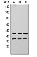 Polyclonal Rabbit anti-Human APOL3 / Apolipoprotein L 3 Antibody (Internal, IHC, WB)