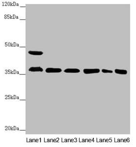 Polyclonal Rabbit anti-Human GNB2 Antibody (IHC, WB)