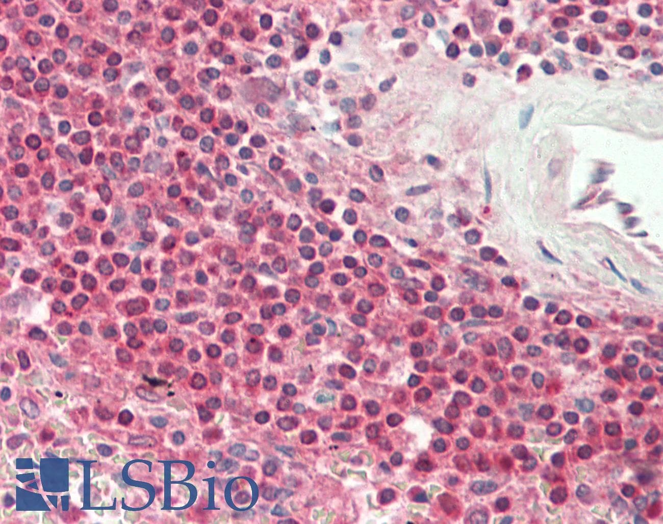 Polyclonal Rabbit anti-Human AIRE Antibody (N-Terminus, IHC, WB)