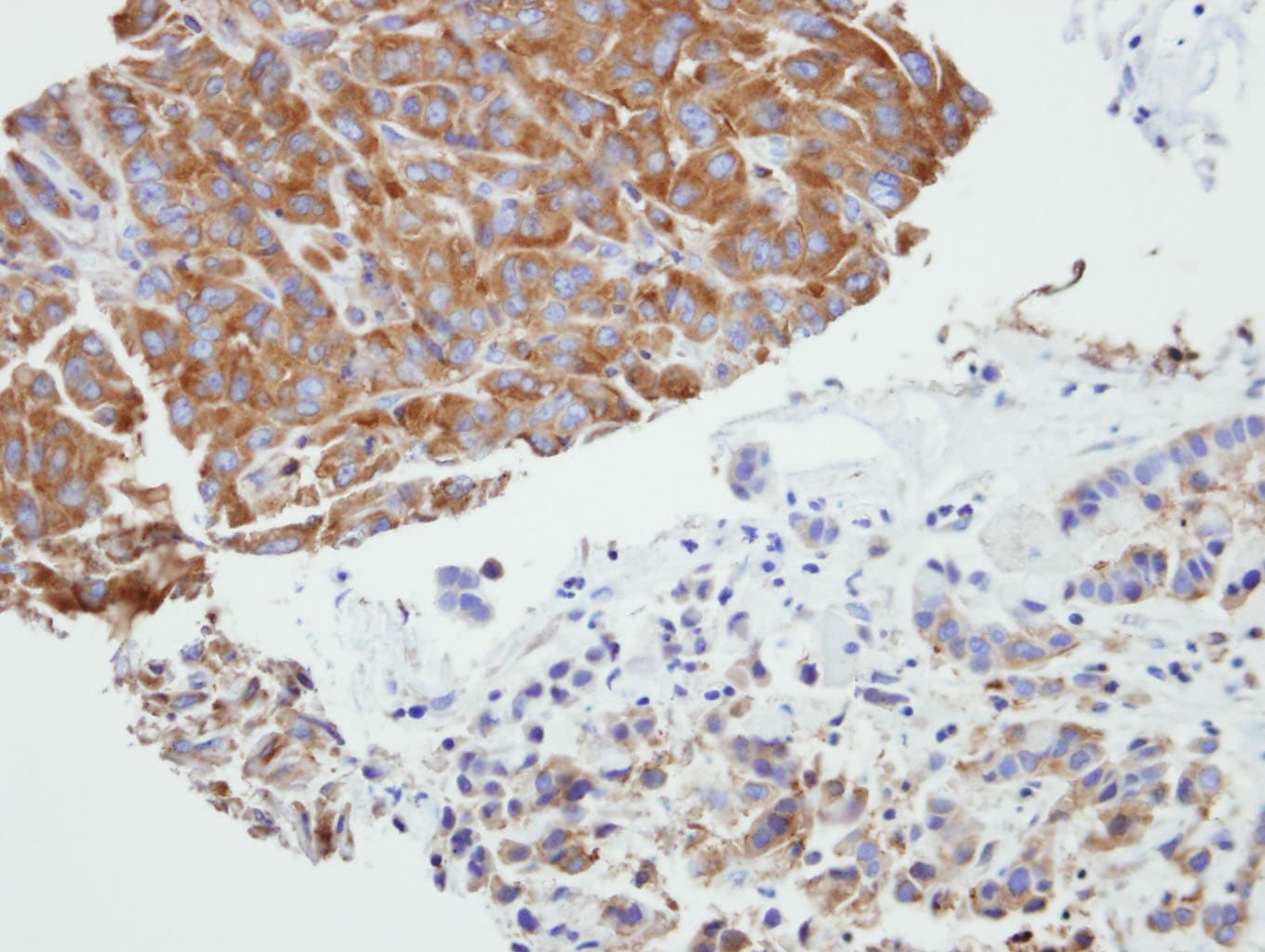 PRPSAP2 Antibody (aa1-369)