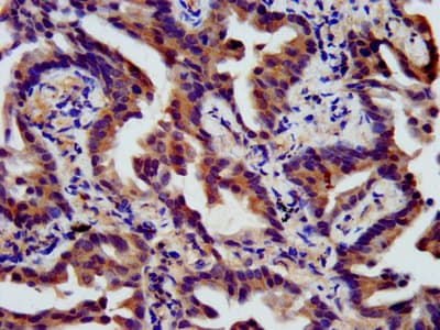 Polyclonal Rabbit anti-Human SSH3 Antibody (IHC, IF, WB)