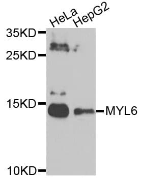 Polyclonal Rabbit anti-Human MYL6 Antibody (WB)