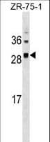SPC25 Antibody (aa87-114)