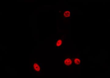 PDIK1L Antibody