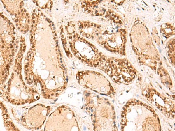 FUNDC2 Antibody