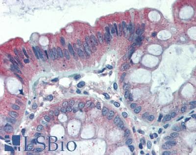 IHC-plus™ Polyclonal Rabbit anti-Human TFG Antibody (aa350-400, IHC, WB)