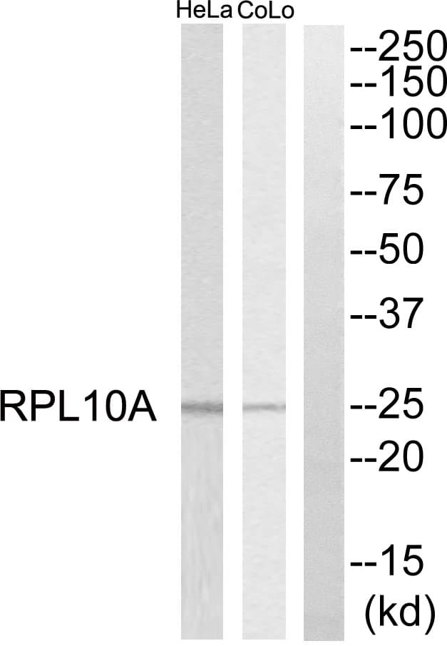 RPL10A Antibody