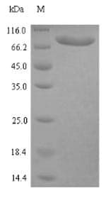 Human CLINT1 Protein (Recombinant 6His, N-terminus)