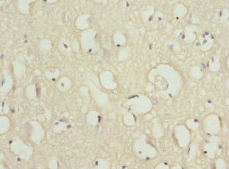 SCN2B Antibody