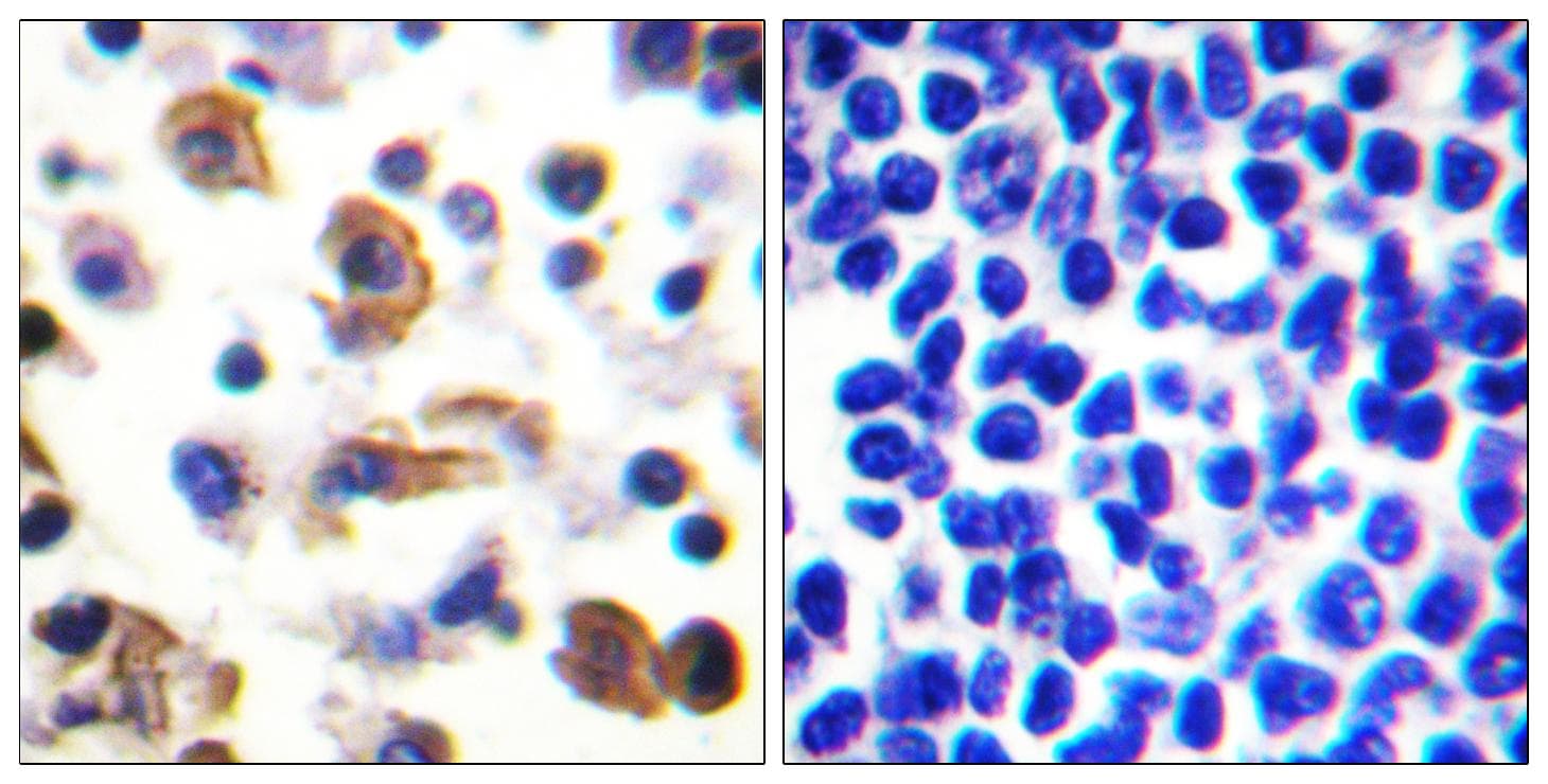IL9R / CD129 Antibody