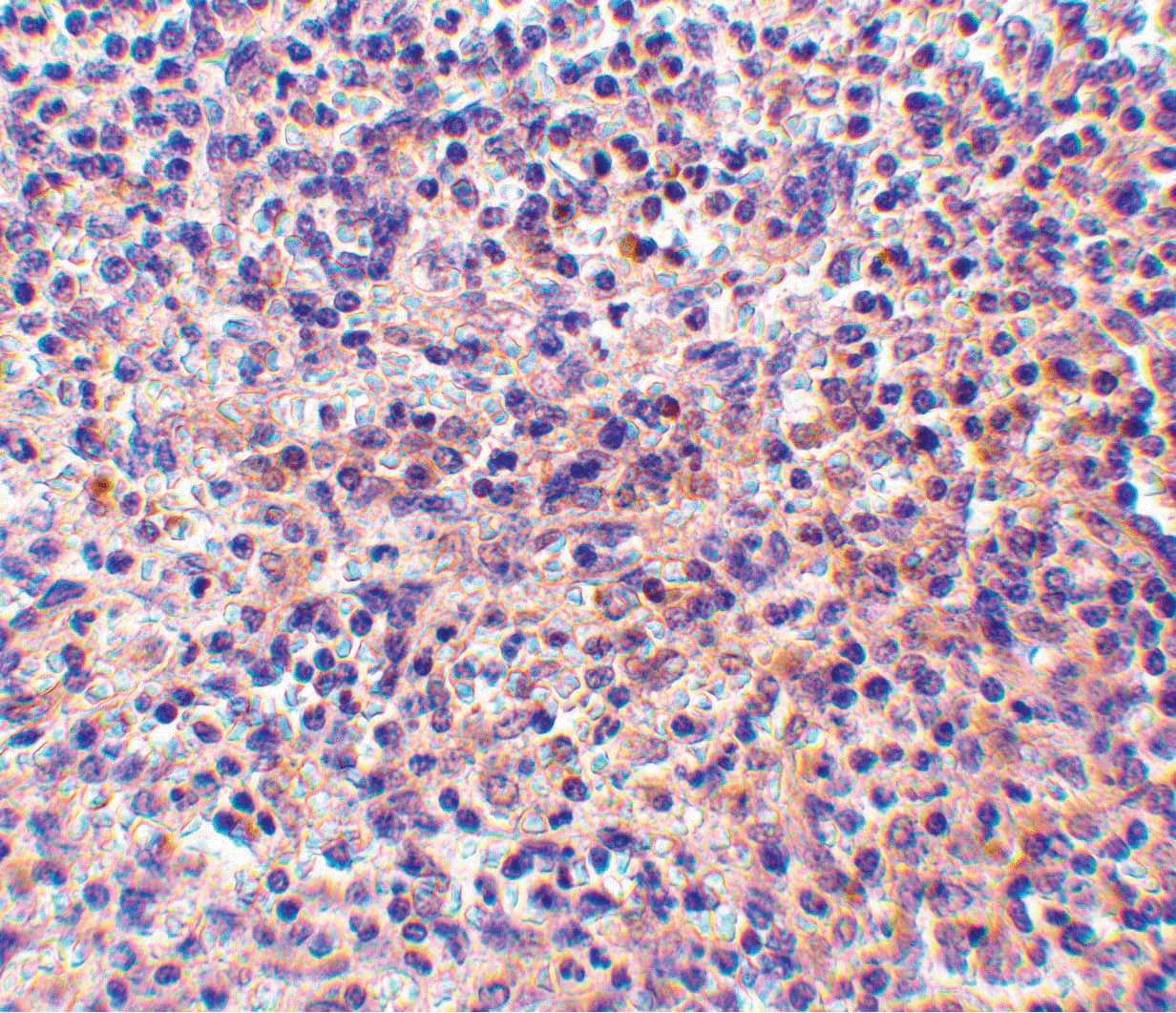 RP105 / CD180 Antibody