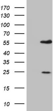 IHC-plus™ MNDA Antibody (aa37-321, clone 4H6)