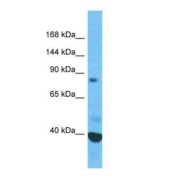SFMBT1 Antibody (aa531-580)