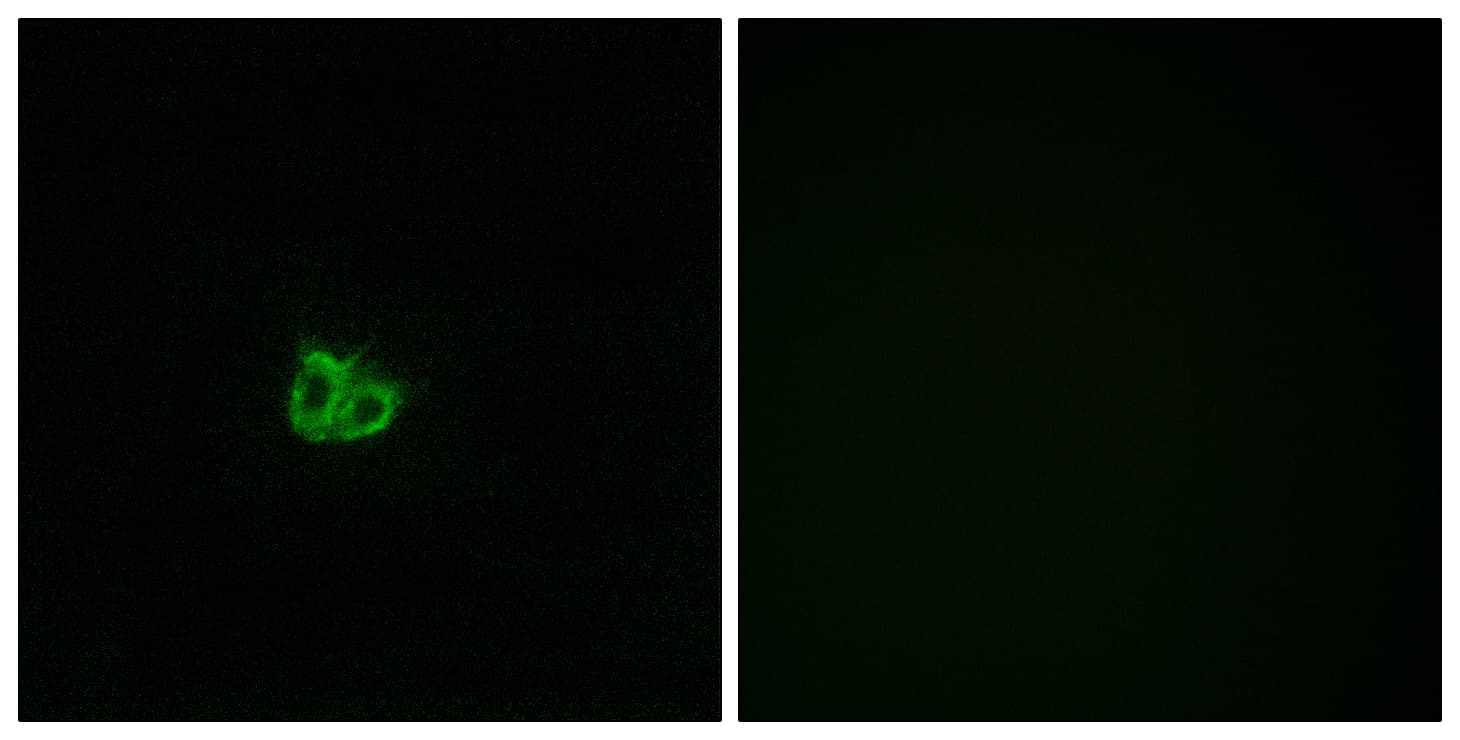 Polyclonal Rabbit anti-Human STMN1 / Stathmin / LAG Antibody (phospho-Ser15, IHC, IF, WB)