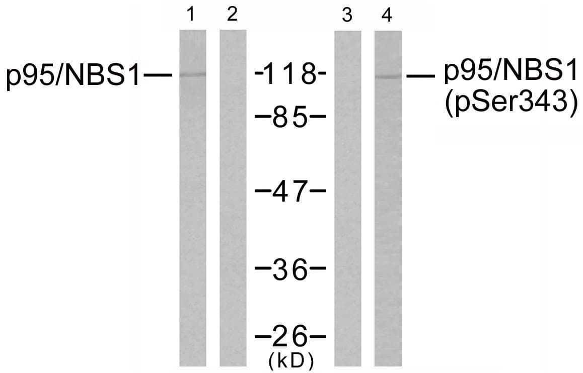 NBN / Nibrin Antibody (p343)