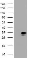 Monoclonal Mouse anti-Human QPRT Antibody (clone OTI3B3, IF, WB)